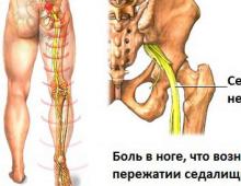 Задняя группа мышц бедра: строение, функции и упражнения Задняя мышца